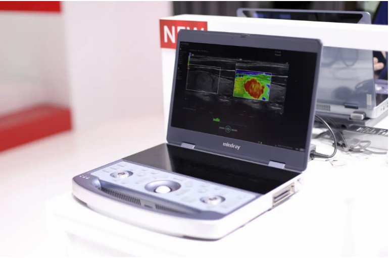 (mx 7便携式彩色多普勒超声系统)