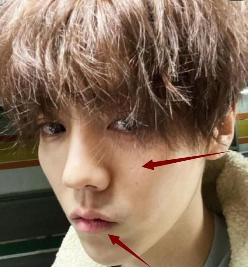 鹿晗晒自拍痘印皮肤暗黄看到嘴上痕迹慌了女粉急召关晓彤