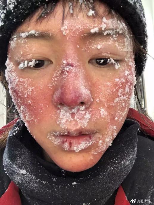 女神张静初自爆,将少女肌拿捏得死死的秘诀竟然是