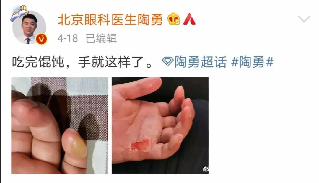 对话董卿后,被砍医生陶勇的"真面目"藏不住了