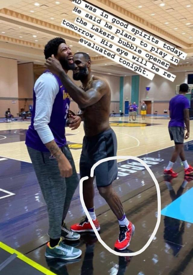 大腿如水桶,球迷被撞进医院|詹姆斯|水桶|大腿_新浪新闻