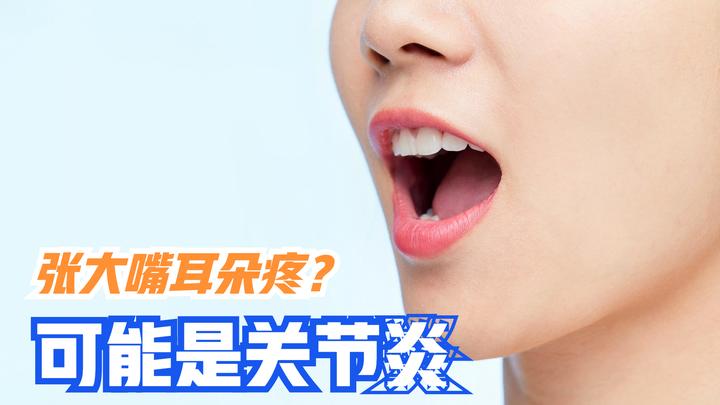 张嘴耳朵与脸交界处痛,还能听到耳朵里"咔咔响",可能是关节炎