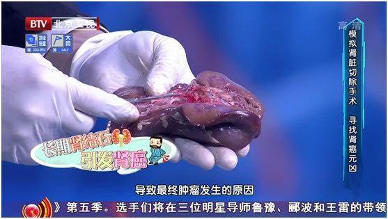 已致6人肾损伤！这种"长寿菜"，很多人都爱吃休闲区蓝鸢梦想 - Www.slyday.coM