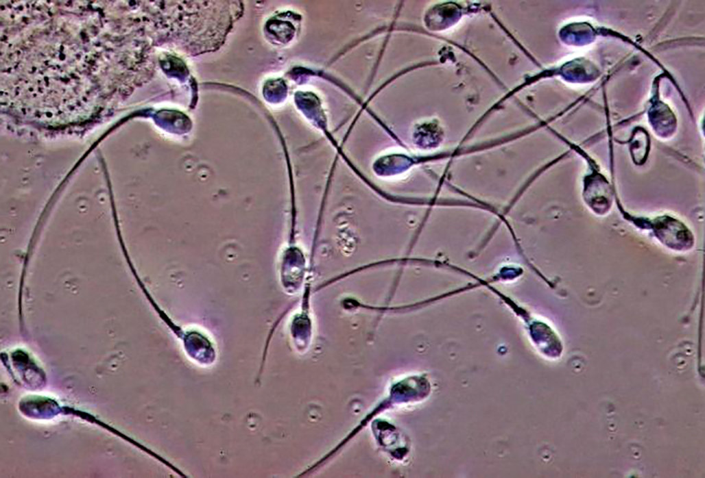 只能看到精子的二维运动方式,精子看起来如同鱼在左右摆动尾巴前进一
