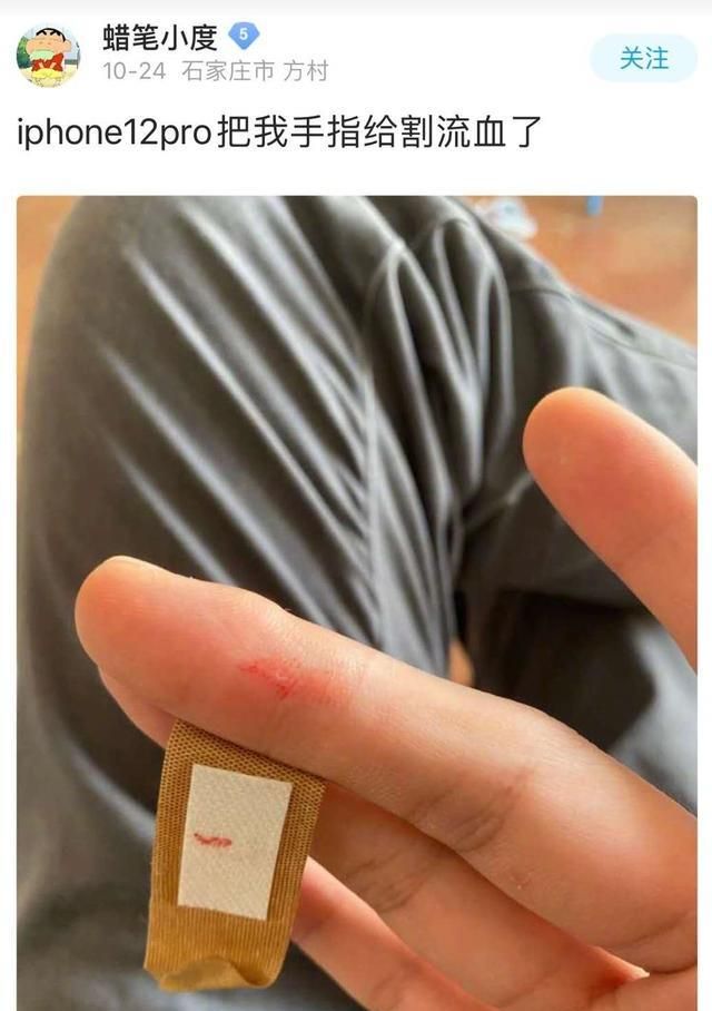 iphone12pro割伤手指索尼曝光新型镜片技术