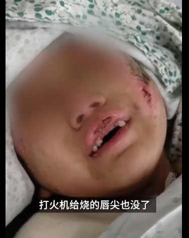 沸水浇头、铁钳拔牙、烧嘴唇...6岁女童被亲妈和男友狂虐3个月 外婆报警还收到死亡威胁休闲区蓝鸢梦想 - Www.slyday.coM