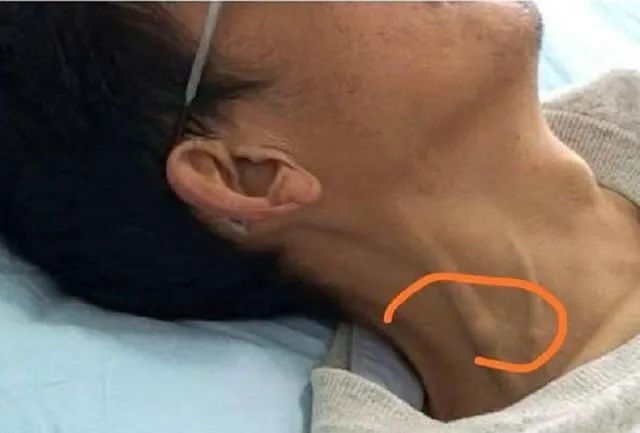 大多数人多这个数字可能无感,咱们打个直观点的比方:如果脖子一直被