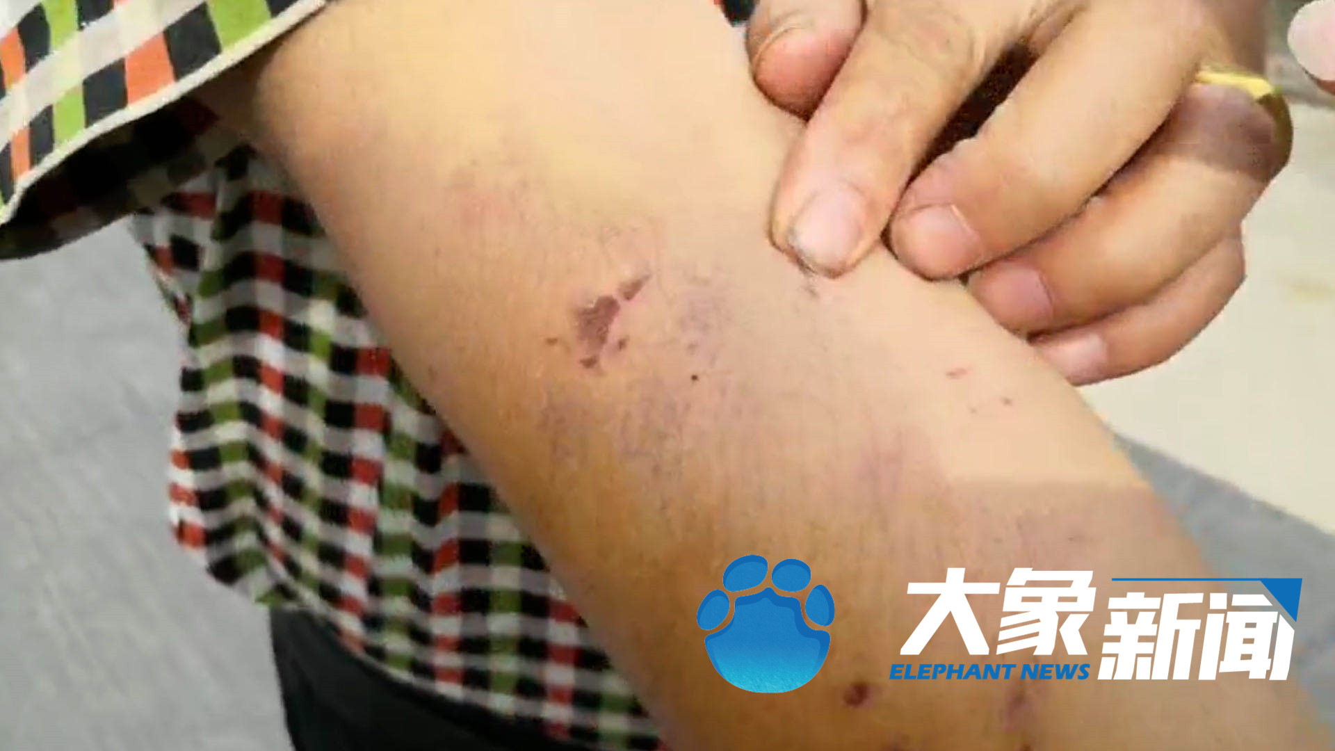 北青网综合|马戏团驯兽师回应被黑熊咬数分钟：没牙 从小就锯掉了