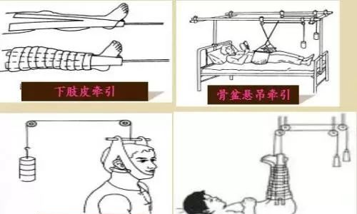 这个方法,专治腰突,每天一次,10年腰突都能解决,在家就能做