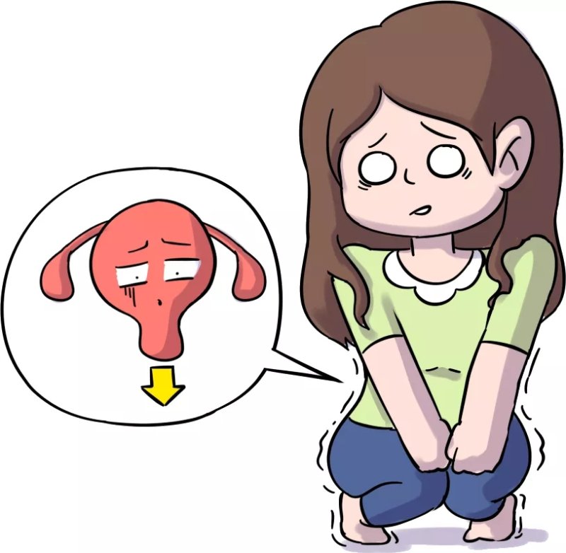 "掉"下来的难言之隐-子宫脱垂