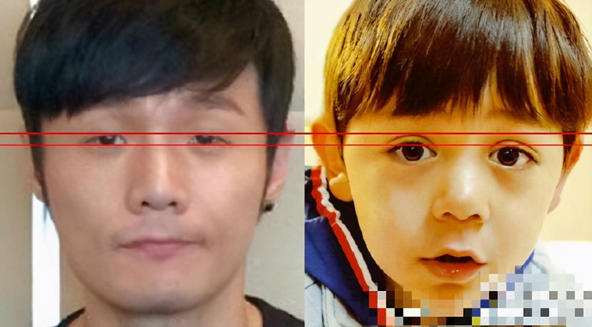 宝宝长成"豆豆眼"急坏妈妈,医生却笑说:没事,就是眼睛小点|宝宝|豆豆