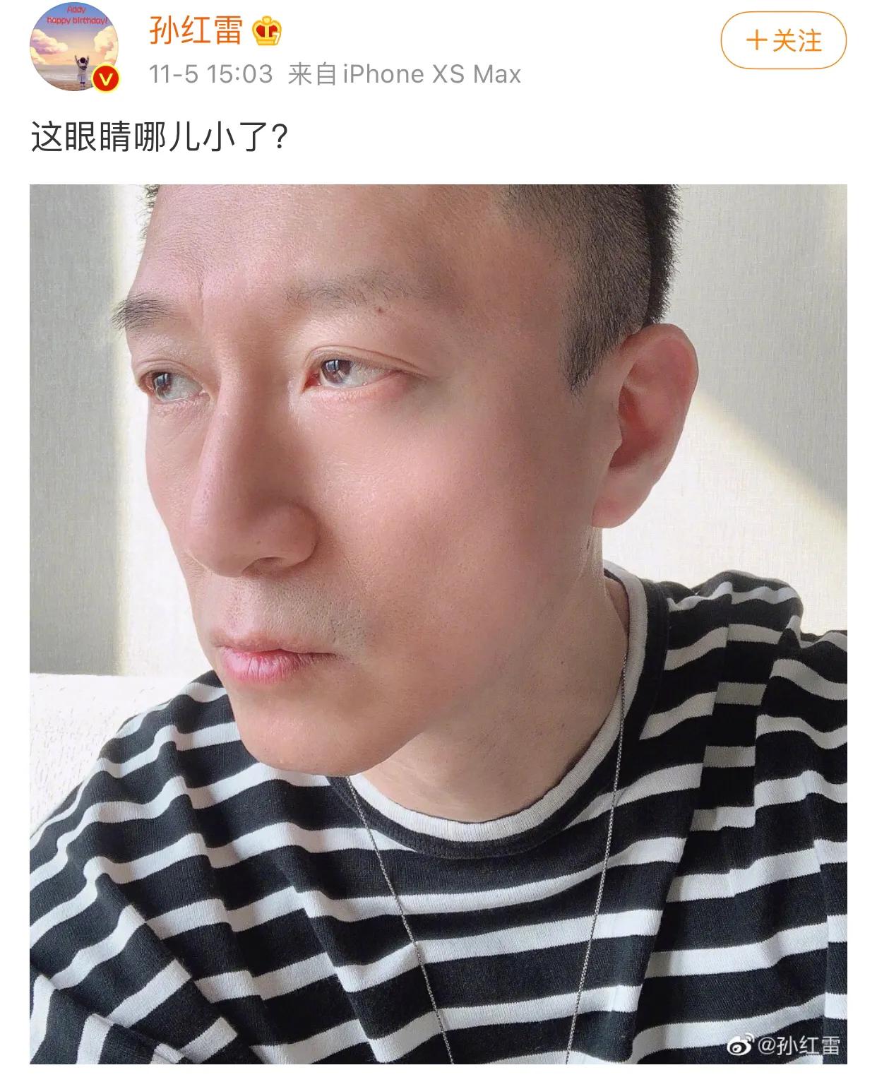 孙红雷晒自拍照脸颊凹陷,眼睛"变大",为新戏努力减肥效果明显