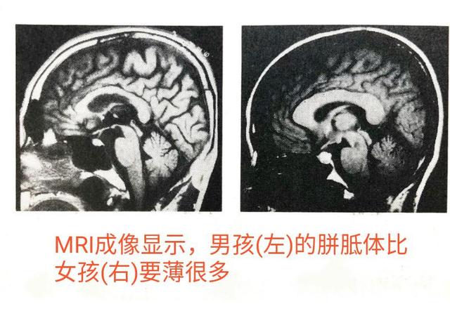 男孩开窍晚7岁前用3招来训练胼胝体帮助孩子尽早开窍