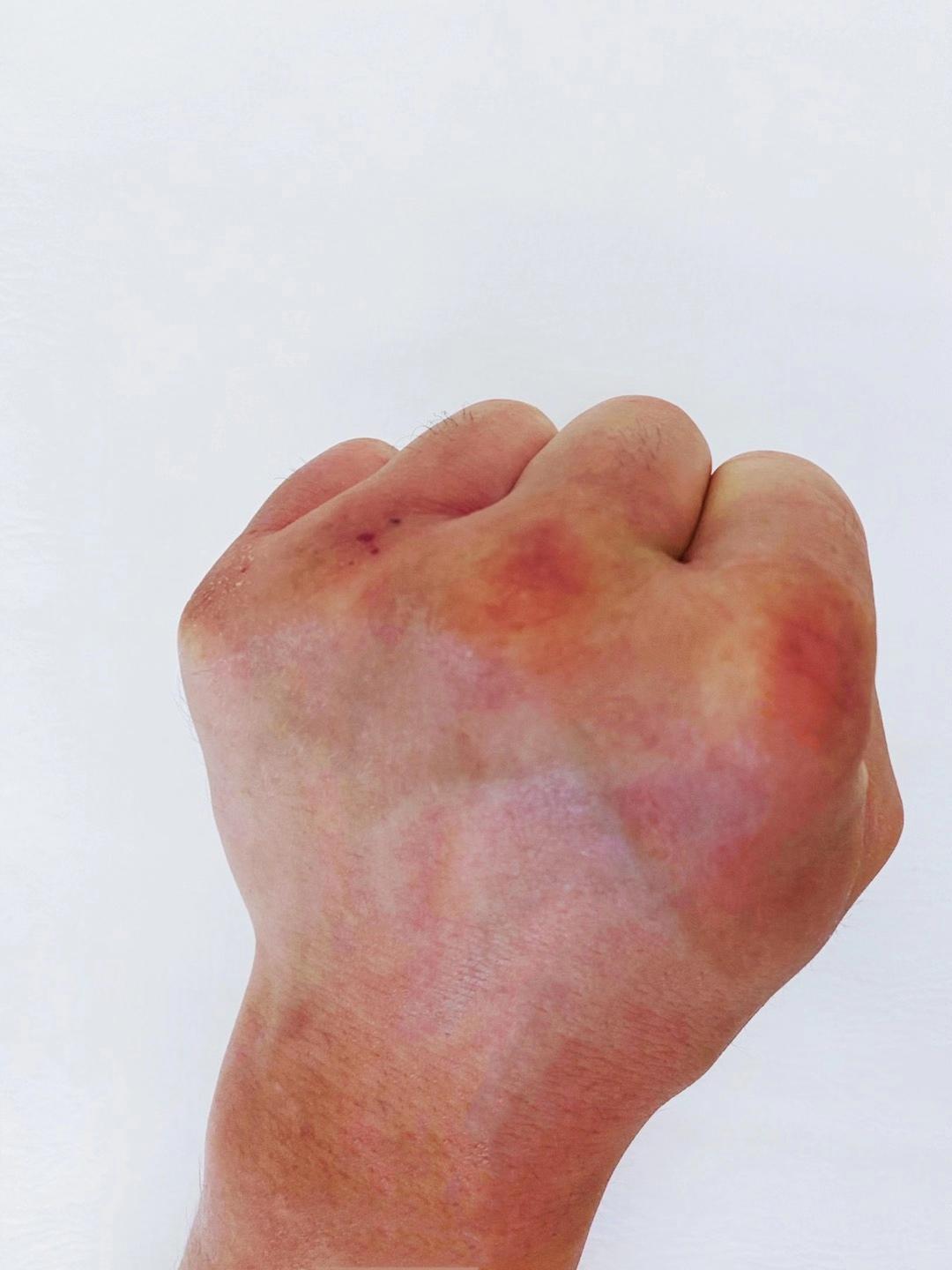 武僧一龙疯狂备战将拳头打肿,三番战有望速杀泰拳王播求