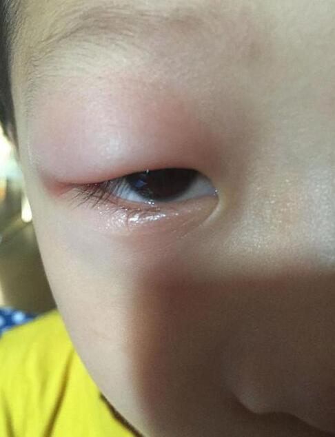 家长愚昧的4个喂饭误区,及时拿下它,不让宝宝受积食困扰!