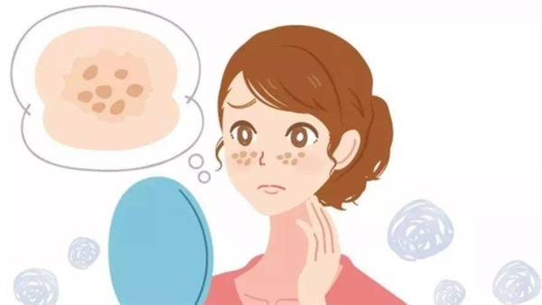 其实它是皮肤的忠诚卫士