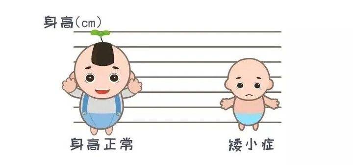 济南六一儿童医院专家详解:怎样判断孩子是否患有矮小症?
