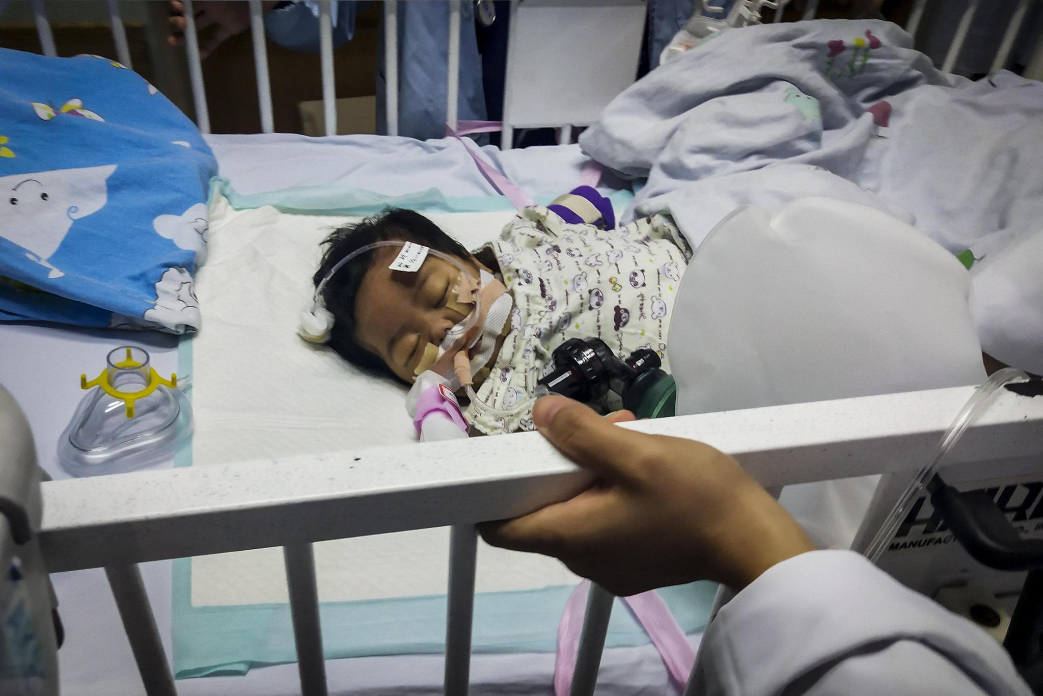 半岁重症女婴肚大如西瓜村民说是怪物母亲却舍命割肝救女