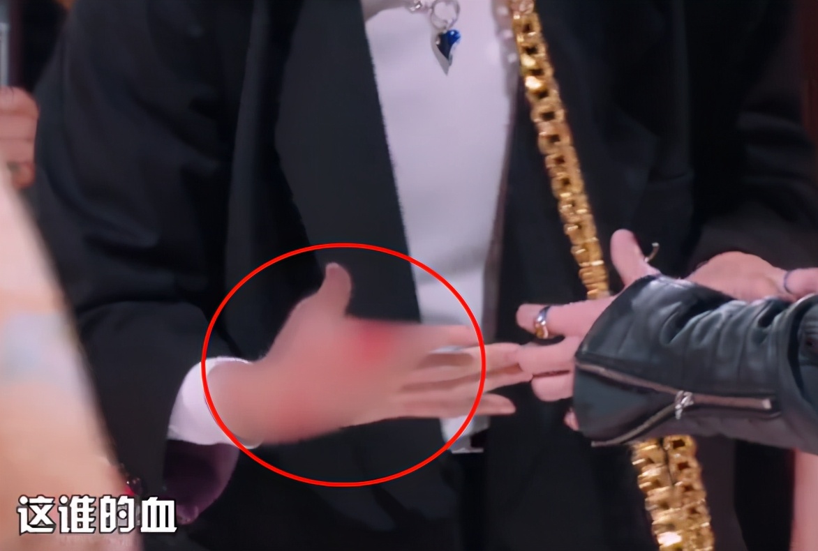 敖犬录节目手掌突被割开血溅薛之谦脖颈送医缝合多针