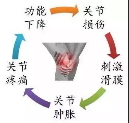 多年的腿疼老毛病终于消失了|滑膜炎|膝关节|膝盖_新浪新闻