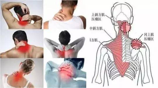颈椎病压迫神经粗盐加上它效果太厉害头晕手麻全赶走