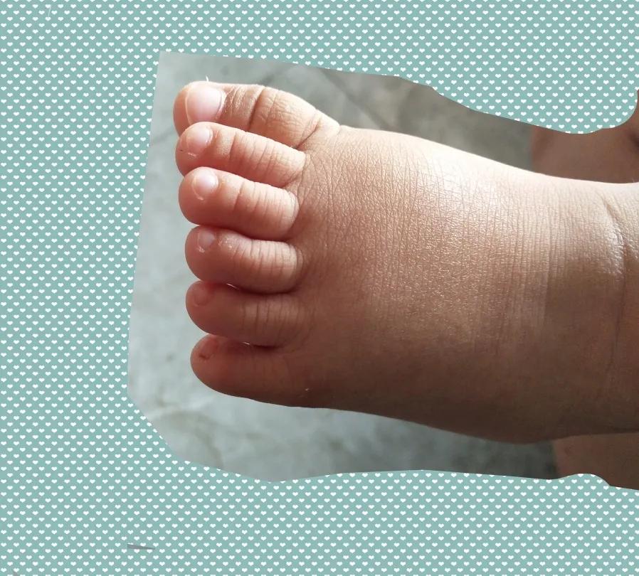 娃娃漂亮的小脚丫6个脚趾医生指尖上绣花再看