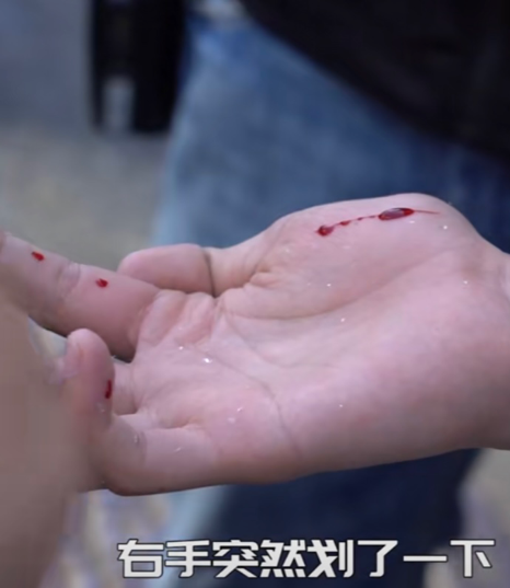 王宝强刘昊然片场意外受伤,手被玻璃割破血流不止,网友直呼心疼