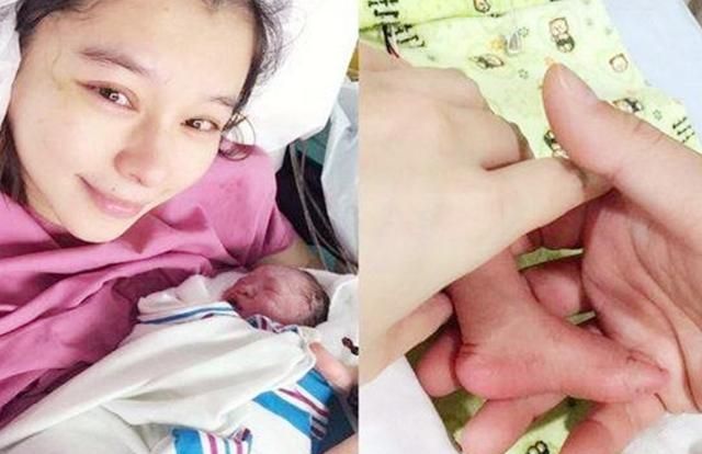 原因,有一部分原因是很多明星在生娃时都会选择剖腹产的方式,例如谢娜