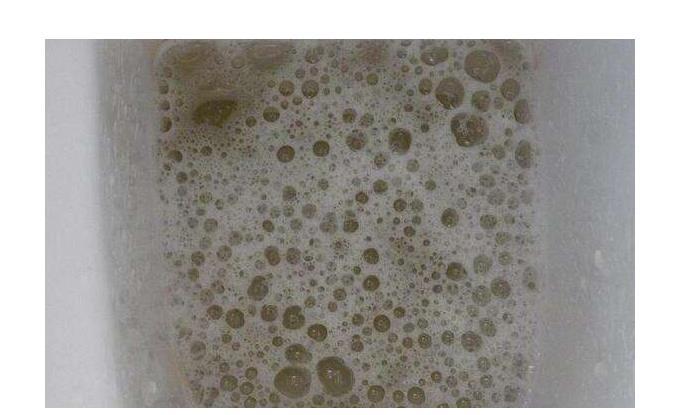 尿液里有很多泡沫是不是肾出了问题是这两种情况不用太担心