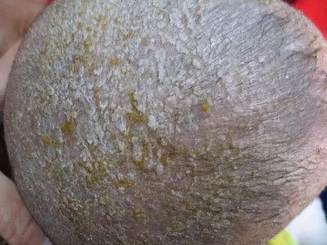 宝妈不要乱信,做好3点才是关键|王珍|宝妈|头皮_新浪新闻