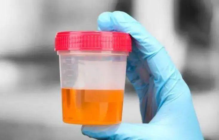 43岁男子，查出肾癌，这5个日常行为，十分伤肾，再难也要坚持改休闲区蓝鸢梦想 - Www.slyday.coM