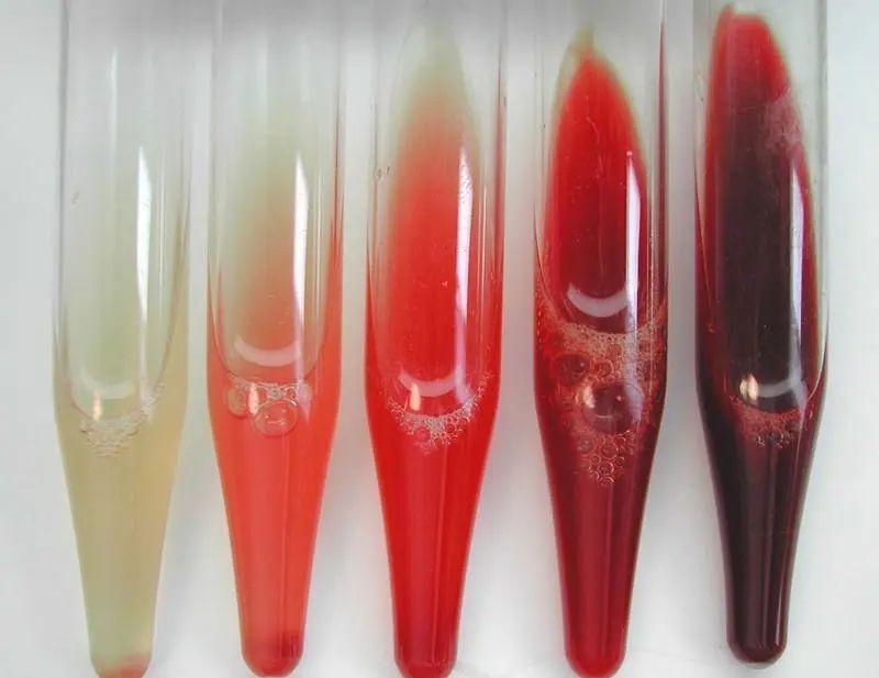 43岁男子，查出肾癌，这5个日常行为，十分伤肾，再难也要坚持改休闲区蓝鸢梦想 - Www.slyday.coM