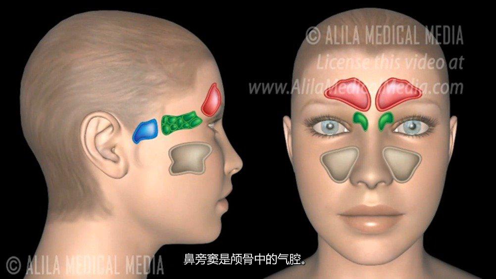 鼻窦炎的形成原因及过程！……_新浪新闻