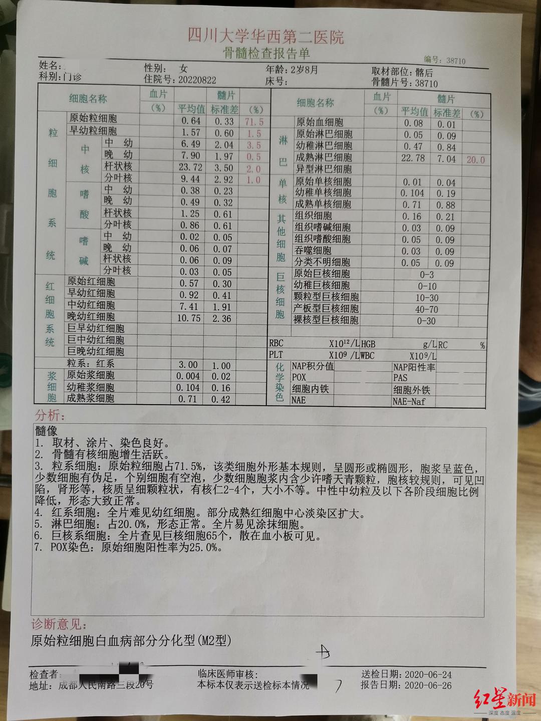 儿童白血病化验单图片