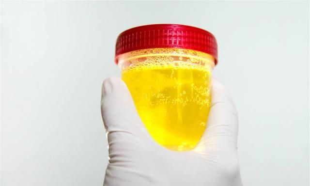 肾受了"委屈",睡觉时多半会有3个症状,忌口4物,肾也许感激你|肾脏|忌