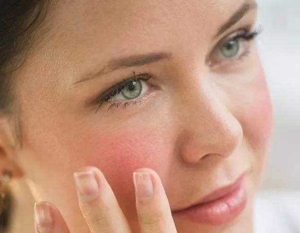 集美们，皮肤泛红可以用那个东方佰丽褪红修颜瓶修复吗？