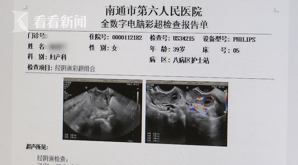 怀孕一个月的B超图片图片