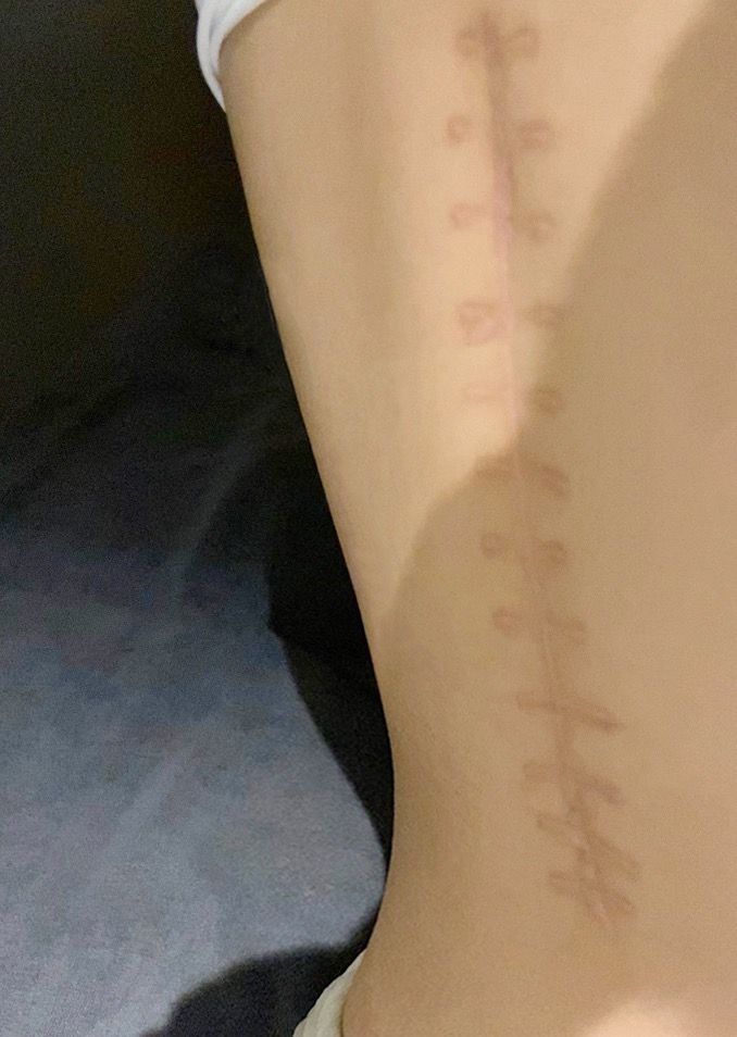 家暴之后一个县城女人的伤痛与选择