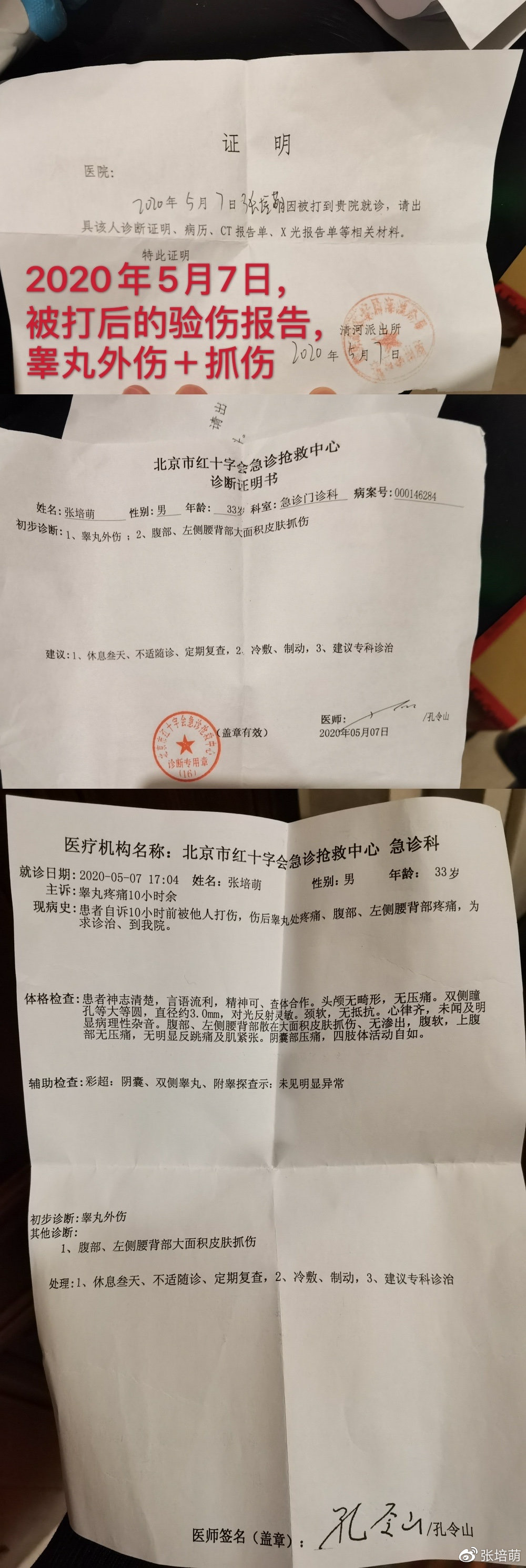 一直羞于出示的医院验伤报告