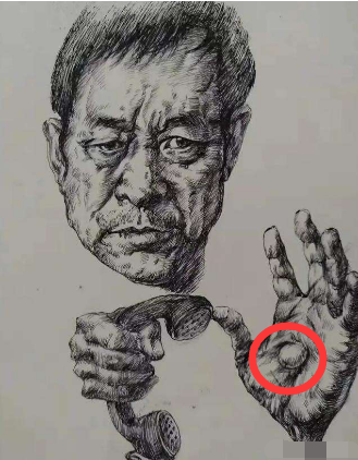 马保国的太极总开关之手心肉球切除了功夫层次高割掉也没影响