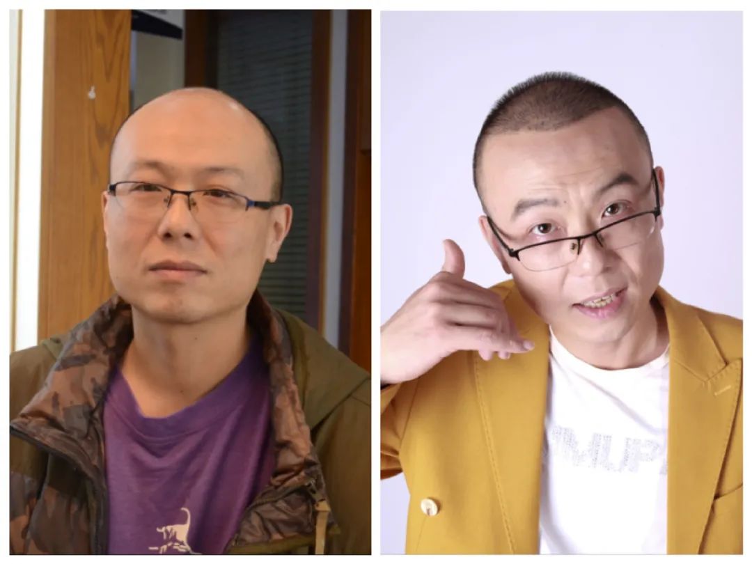 属实不甘脱发变油腻80后老师竟用了4小时长出真头发值得脱发秃顶人