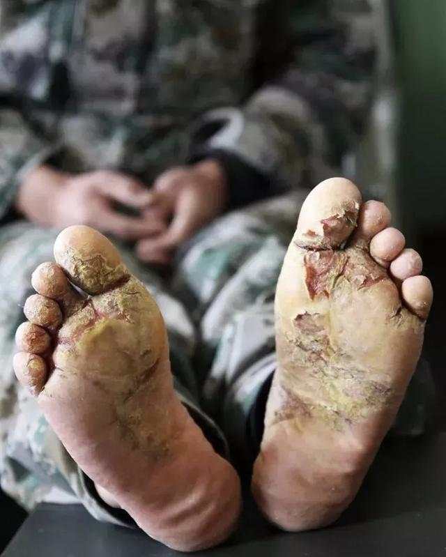 吸着氧气站岗的边防军人