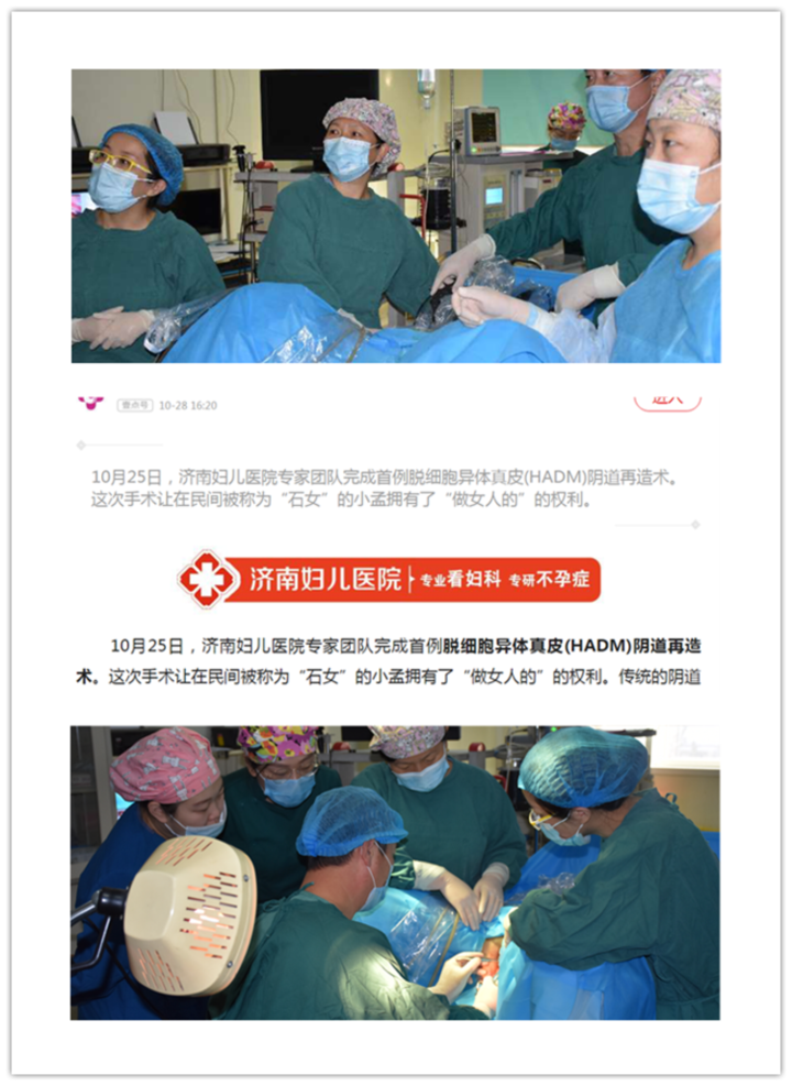 手术改变人生济南妇儿医院成功实施多例石女阴道再造术