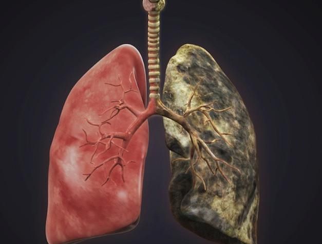 吸烟多久肺会变黑身体有4种表现或是你的肺不行了