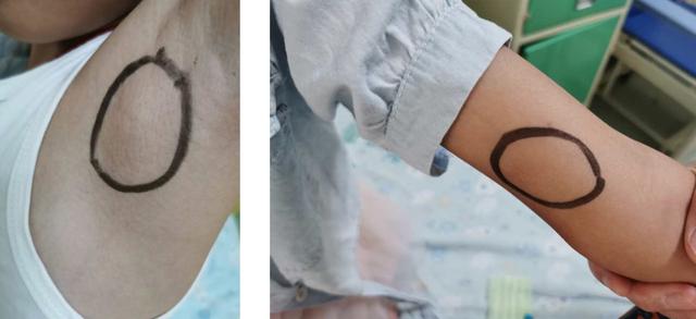 撸猫有风险！广东9岁女孩手指流脓、身上出现肿块，竟与这件事有关……休闲区蓝鸢梦想 - Www.slyday.coM