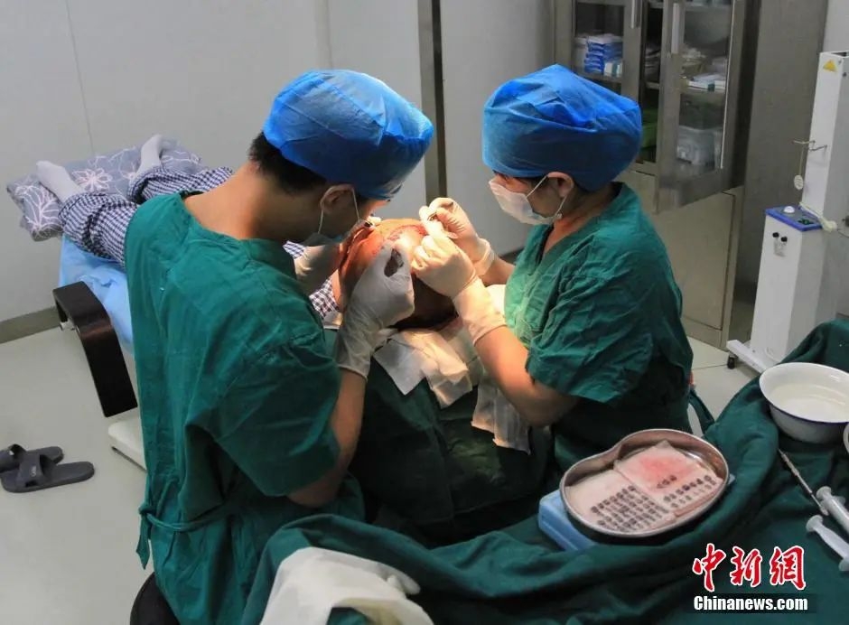 北京永和植发中心，一名患者正在接受植发手术。图片来源：中新网 中新社 潘旭临 摄