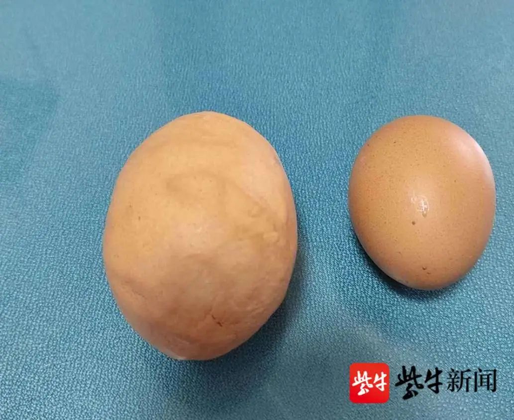 长斑的鸡蛋就是感染了沙门氏菌吗_传染病知识_上海凯创生物技术有限公司