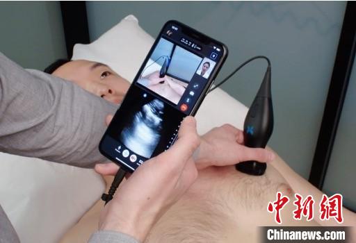 全身通用的掌上超声成像系统.复星供图