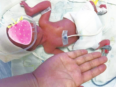 出生仅500克的“巴掌宝宝”出院了 这是河南救治成功的最低体重新生儿休闲区蓝鸢梦想 - Www.slyday.coM