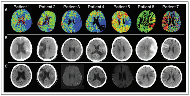 9脑科学日报| csc:让造血干细胞"返老还童的秘密"藏在线粒体里;怀孕